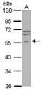 Peripherin antibody, NBP2-19774, Novus Biologicals, Western Blot image 