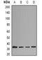 Histamine N-Methyltransferase antibody, LS-B14830, Lifespan Biosciences, Western Blot image 