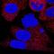 Lactate Dehydrogenase A antibody, MAB9216, Novus Biologicals, Immunocytochemistry image 
