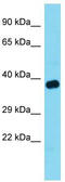 Target Of Myb1 Like 1 Membrane Trafficking Protein antibody, TA343175, Origene, Western Blot image 