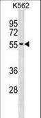 UTP3 Small Subunit Processome Component antibody, LS-C157338, Lifespan Biosciences, Western Blot image 