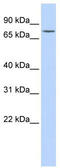 Galactosylceramidase antibody, TA336244, Origene, Western Blot image 