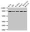 Semaphorin 3A antibody, CSB-PA613506LA01HU, Cusabio, Western Blot image 