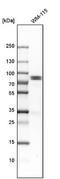 Holliday Junction Recognition Protein antibody, NBP1-85025, Novus Biologicals, Western Blot image 