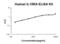 Interleukin 15 Receptor Subunit Alpha antibody, EK1663, Boster Biological Technology, Enzyme Linked Immunosorbent Assay image 