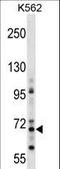 Zinc Finger Protein 256 antibody, LS-C157431, Lifespan Biosciences, Western Blot image 