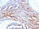 TAG-72 antibody, V2361IHC-7ML, NSJ Bioreagents, Immunohistochemistry frozen image 
