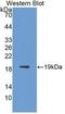 Interleukin 1 Receptor Antagonist antibody, LS-C663574, Lifespan Biosciences, Western Blot image 