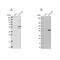 Acyl-CoA Synthetase Bubblegum Family Member 1 antibody, NBP2-31990, Novus Biologicals, Western Blot image 