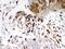 Insulin Like Growth Factor Binding Protein 1 antibody, PA5-79446, Invitrogen Antibodies, Immunohistochemistry frozen image 
