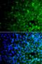 Ubiquitin Specific Peptidase 10 antibody, LS-C349200, Lifespan Biosciences, Immunofluorescence image 