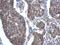 Acyl-CoA Synthetase Long Chain Family Member 3 antibody, NBP2-15252, Novus Biologicals, Immunohistochemistry paraffin image 