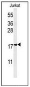 Inner Mitochondrial Membrane Peptidase Subunit 2 antibody, AP52204PU-N, Origene, Western Blot image 