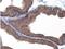 Cadherin 1 antibody, NBP2-16258, Novus Biologicals, Immunohistochemistry paraffin image 