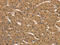 Adhesion G Protein-Coupled Receptor E5 antibody, CSB-PA558771, Cusabio, Immunohistochemistry paraffin image 