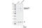 Forkhead Box O1 antibody, 9465T, Cell Signaling Technology, Western Blot image 