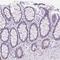 Prolactin antibody, NBP2-56148, Novus Biologicals, Immunofluorescence image 