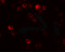 Autophagy Related 2B antibody, 7005, ProSci, Immunofluorescence image 