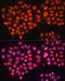 ATP Binding Cassette Subfamily B Member 8 antibody, 18-750, ProSci, Immunofluorescence image 