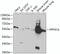 Protein Phosphatase 3 Catalytic Subunit Alpha antibody, GTX32485, GeneTex, Western Blot image 