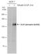 Unc-51 Like Autophagy Activating Kinase 1 antibody, PA5-78249, Invitrogen Antibodies, Western Blot image 