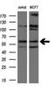 Natriuretic Peptide Receptor 3 antibody, M03589-2, Boster Biological Technology, Western Blot image 