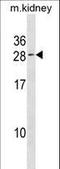Vacuolar Protein Sorting 25 Homolog antibody, LS-C157034, Lifespan Biosciences, Western Blot image 