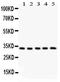 Hydroxysteroid 11-Beta Dehydrogenase 1 antibody, PA5-79398, Invitrogen Antibodies, Western Blot image 