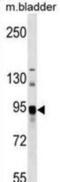 N-Acylsphingosine Amidohydrolase 2 antibody, abx025039, Abbexa, Western Blot image 