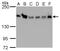 Rho Associated Coiled-Coil Containing Protein Kinase 1 antibody, GTX629971, GeneTex, Western Blot image 