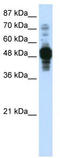 Zinc Finger Protein 296 antibody, TA329345, Origene, Western Blot image 