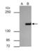 Rho Associated Coiled-Coil Containing Protein Kinase 1 antibody, PA5-22262, Invitrogen Antibodies, Immunoprecipitation image 