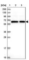 T-Complex 11 Like 2 antibody, NBP1-82694, Novus Biologicals, Western Blot image 
