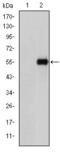Endoglin antibody, GTX60452, GeneTex, Western Blot image 