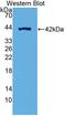 Succinate Dehydrogenase Complex Subunit C antibody, LS-C696356, Lifespan Biosciences, Western Blot image 