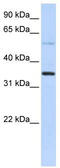 Ankyrin Repeat Domain 9 antibody, TA338815, Origene, Western Blot image 