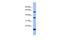 La Ribonucleoprotein Domain Family Member 6 antibody, PA5-41881, Invitrogen Antibodies, Western Blot image 