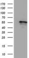 Cytochrome P450 Family 2 Subfamily A Member 6 antibody, MA5-25753, Invitrogen Antibodies, Western Blot image 