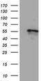 Cytochrome P450 Family 2 Subfamily A Member 6 antibody, MA5-25753, Invitrogen Antibodies, Western Blot image 