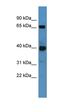 Polypeptide N-Acetylgalactosaminyltransferase 11 antibody, orb325499, Biorbyt, Western Blot image 