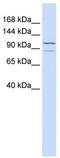 Adenylate Cyclase 6 antibody, TA341966, Origene, Western Blot image 