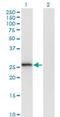 Membrane Spanning 4-Domains A6A antibody, H00064231-M02, Novus Biologicals, Western Blot image 