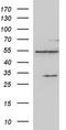 Cytochrome P450 Family 1 Subfamily B Member 1 antibody, TA590005, Origene, Western Blot image 