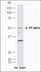 Interleukin 6 Receptor antibody, orb13507, Biorbyt, Western Blot image 