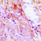 EGFR antibody, LS-B16092, Lifespan Biosciences, Immunohistochemistry frozen image 