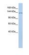 Transmembrane Protein 132B antibody, orb325561, Biorbyt, Western Blot image 