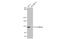 Cadherin 1 antibody, GTX636577, GeneTex, Western Blot image 