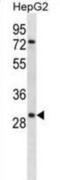 Kallikrein Related Peptidase 10 antibody, abx028139, Abbexa, Western Blot image 