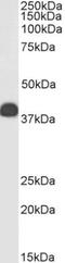 Clusterin antibody, NBP1-06027, Novus Biologicals, Western Blot image 