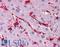 Filamin A antibody, LS-B4865, Lifespan Biosciences, Immunohistochemistry paraffin image 